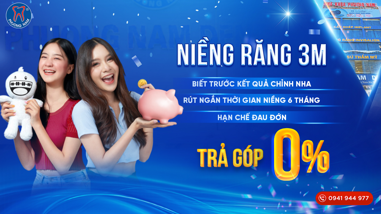 Niềng răng mắc cài 3M