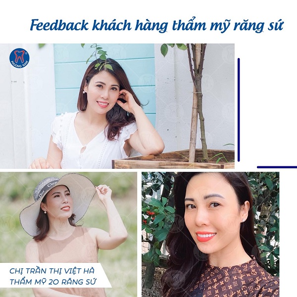 Thay đổi ngoạn mục sau khi bọc răng sứ tại nha khoa Phương Nam - 1