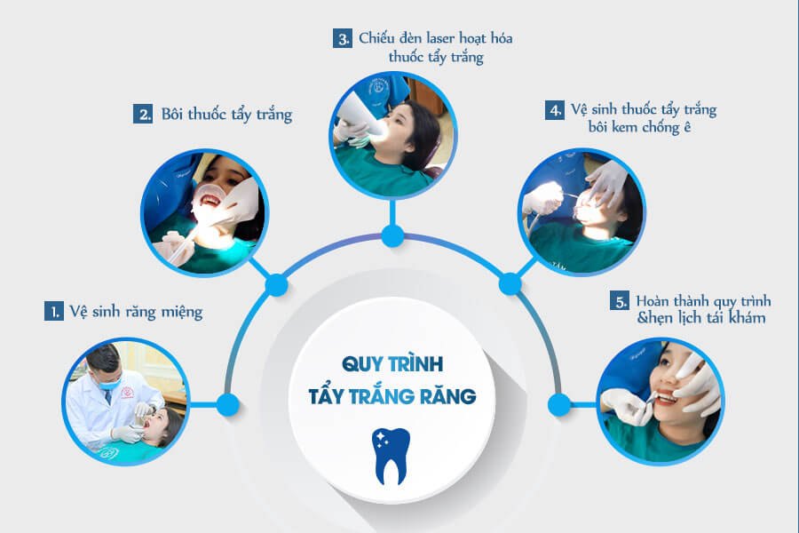 Mô phỏng quá trình tấy trắng răng của khách hàng tại nha khoa Phương Nam - 1