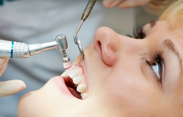 Lấy cao răng đảm bảo an toàn tuyệt đối - 1