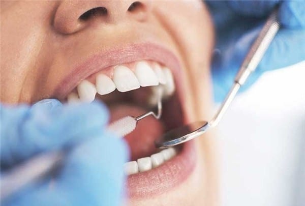 Nhổ răng khôn sẽ không ảnh hưởng nếu bác sĩ lên phác đồ điều trị rõ ràng phù hợp - 1