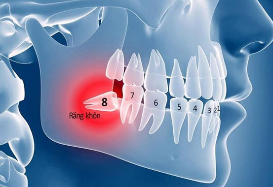 Răng 8 là răng gì?