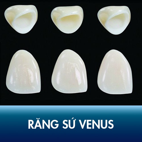 Răng sứ Venus