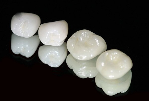 Răng sứ Zirconia là gì
