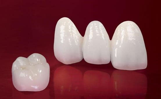 Răng sứ cercon và zirconia khác gì nhau?