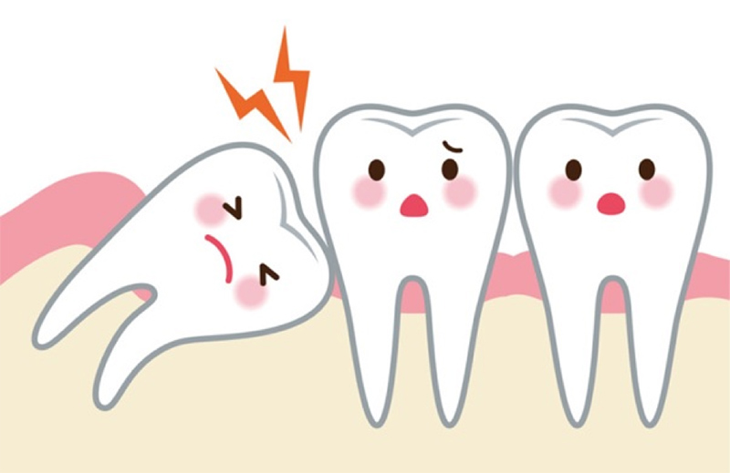 Vì sao mọc răng khôn lại bị đau