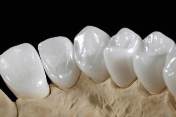 so sánh răng sứ Zirconia và Cercon HT 