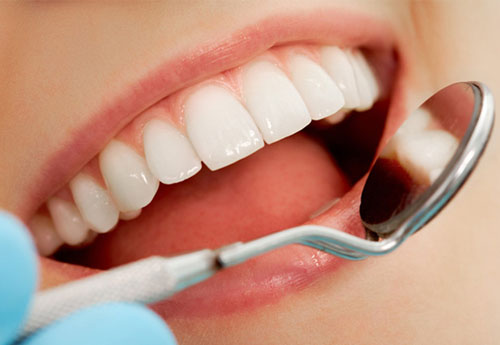 Các biện pháp phòng tránh răng sứ bị rớt ra ngoài hiệu quả