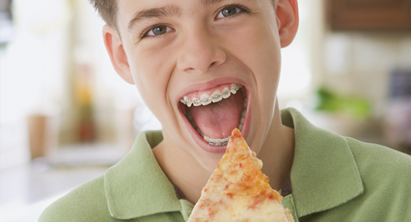 Lưu ý về chế độ ăn uống khi niềng răng cho trẻ