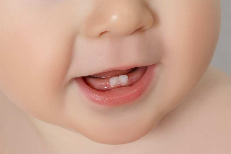 Trẻ dưới 1 tuổi giai đoạn mọc răng sữa