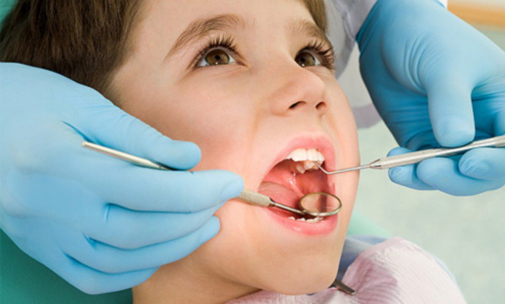 Trẻ em có nên lấy cao răng?