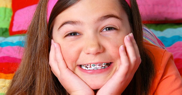 Yếu tố ảnh hưởng đến niềng răng mắc cài kim loại mất bao lâu 