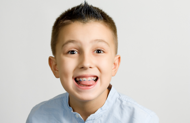 Trẻ em có nên niềng răng hay không?