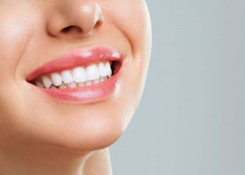 quy trình bọc răng sứ cercon