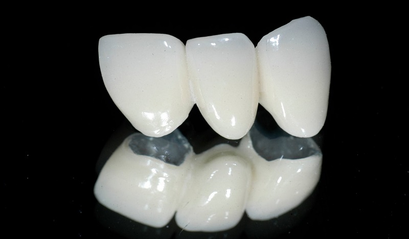 Cách nhận biết răng sứ zirconia Full Solid Zirconia (dạng rắn)