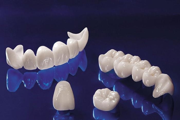 Cách nhận biết răng sứ zirconia Layered Zirconia – Zirconia HT (dạng lớp)