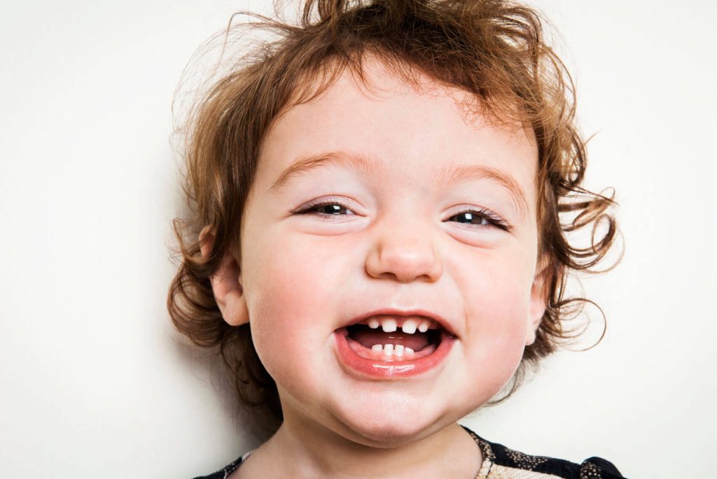 bệnh ăn mòn chân răng ở trẻ em