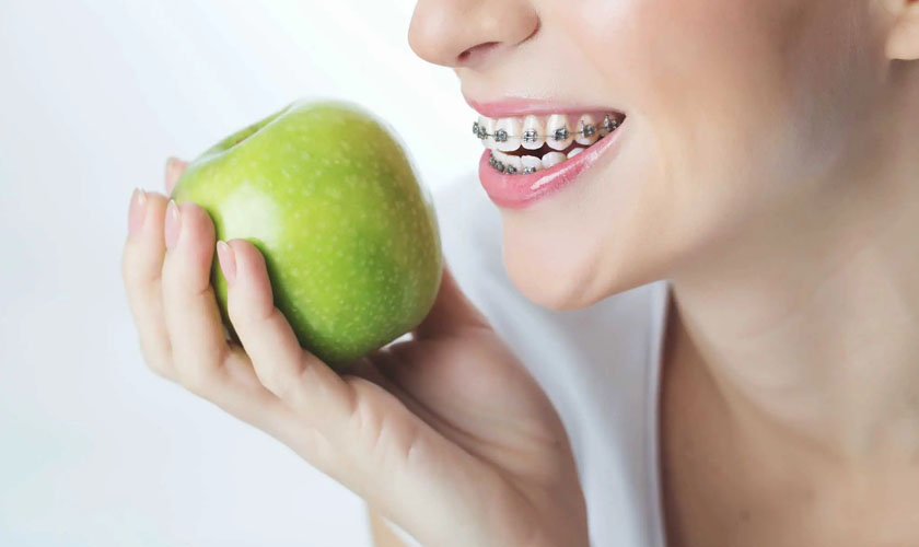 Chế độ ăn uống khi niềng răng