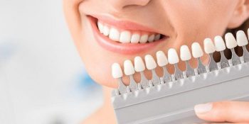 quy trình trồng răng sứ zirconia