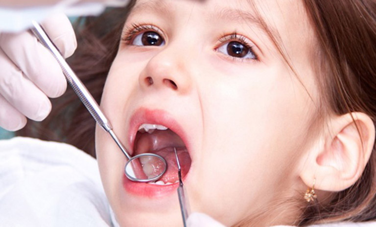 Dấu hiệu bệnh ăn mòn chân răng ở trẻ em