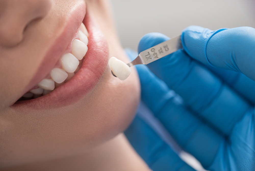 Điều trị sâu răng sau khi bọc răng sứ