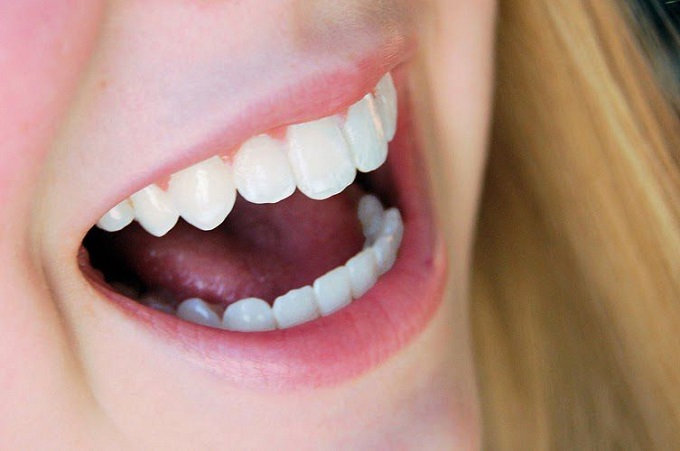 Độ bền của răng sứ Cercon