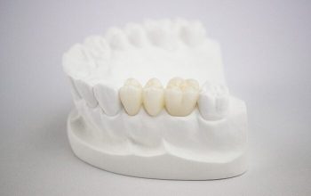 độ bền của răng sứ cercon