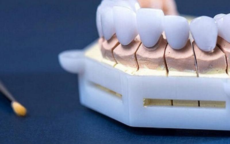 cách bảo quản răng sứ titan