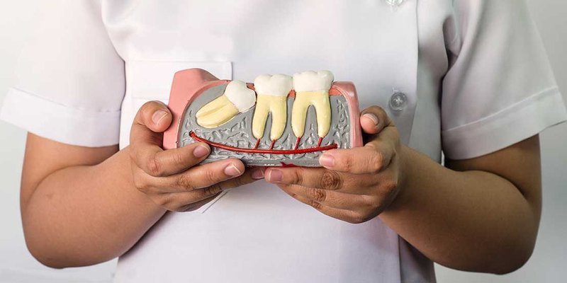 Nhổ răng khôn có cần xét nghiệm máu?