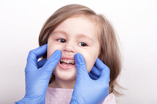 Những dấu hiệu để nhận biết răng của bé bị mủn