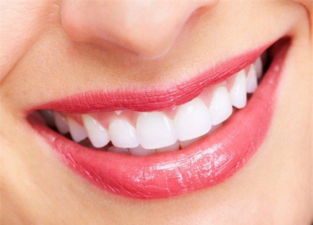 Quá trình điều trị răng sâu nặng bọc răng sứ 