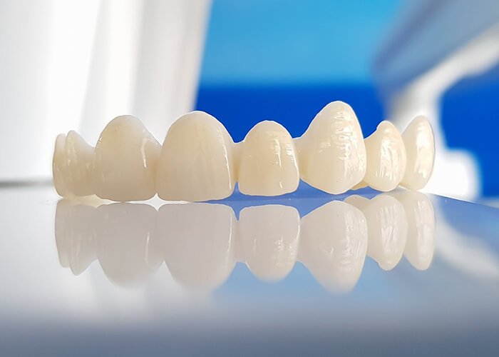 Thông tin chung về răng sứ cercon 