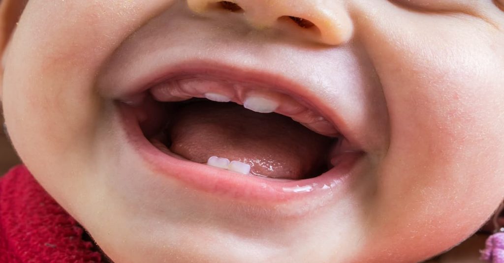 Tuổi mọc răng hàm ở trẻ là khi nào?
