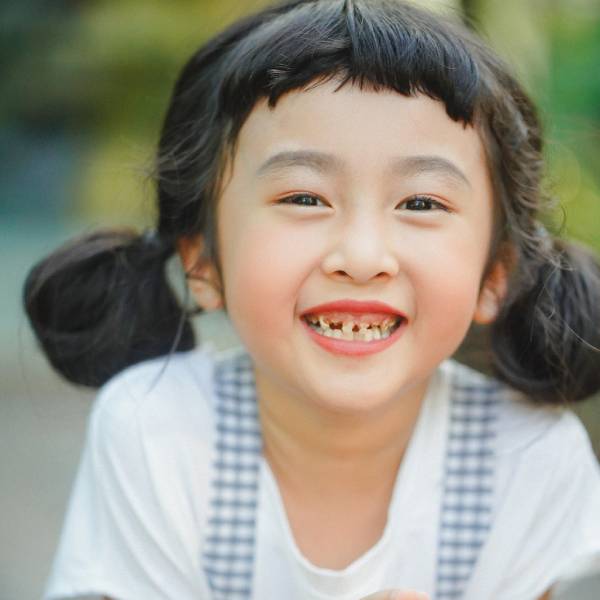 Trẻ em bị sún răng sữa là gì?