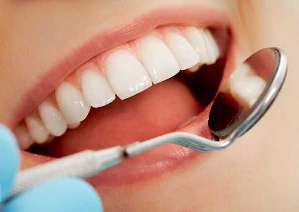 Quy trình bọc răng sứ Cercon diễn ra như thế nào