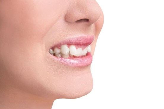 Răng cụp vào trong gây ra những tác hại gì?