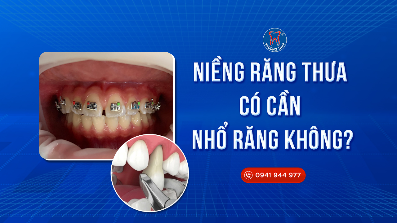 nieng-rang-thua-co-can-nho-ran-khong