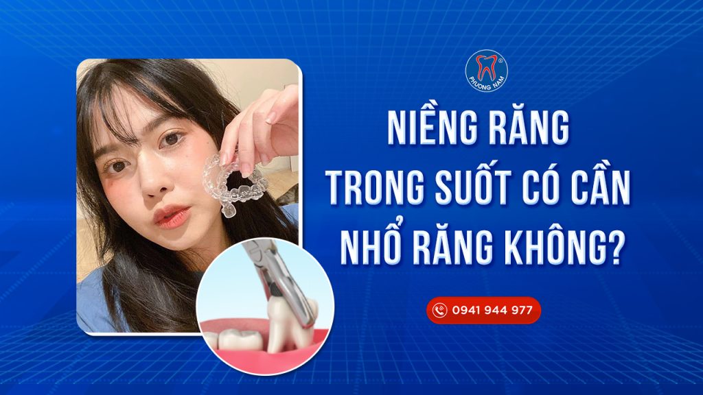 nieng-rang-trong-suot-co-can-nho-rang-khong