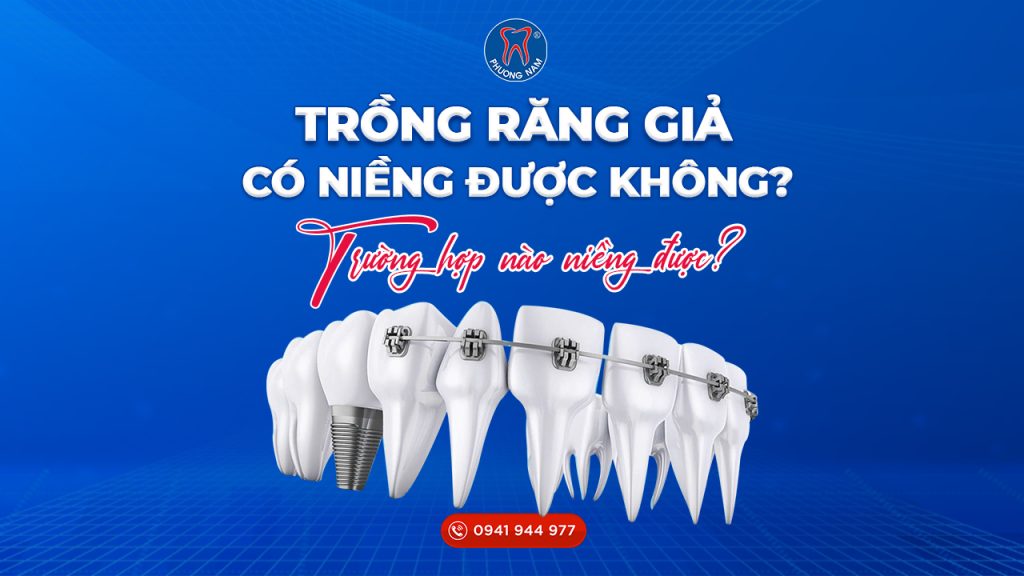 rang-gia-co-nieng-duoc-rang-khong