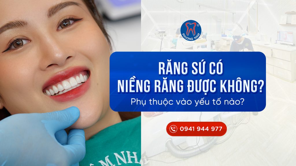 rang-su-co-nieng-rang-duoc-khong