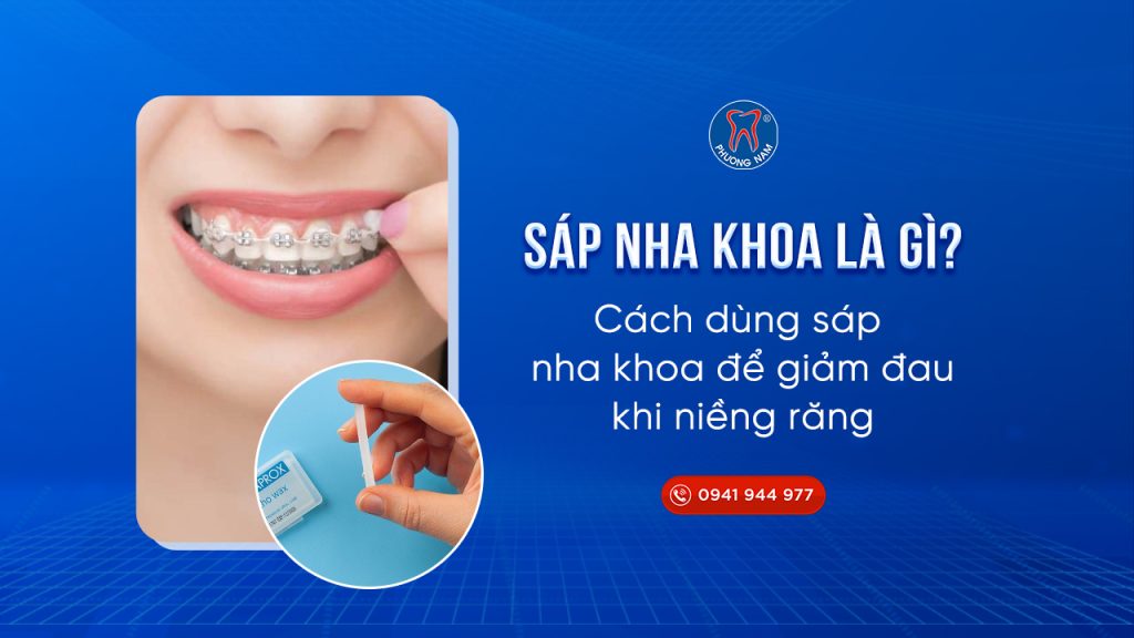 sap-chinh-nha-1