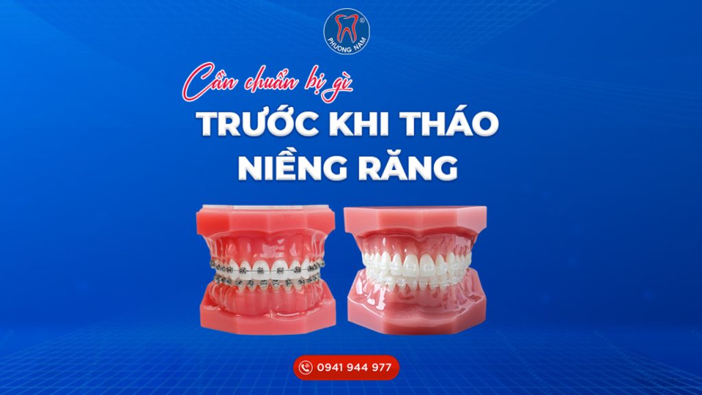 thao-nieng-rang (1)