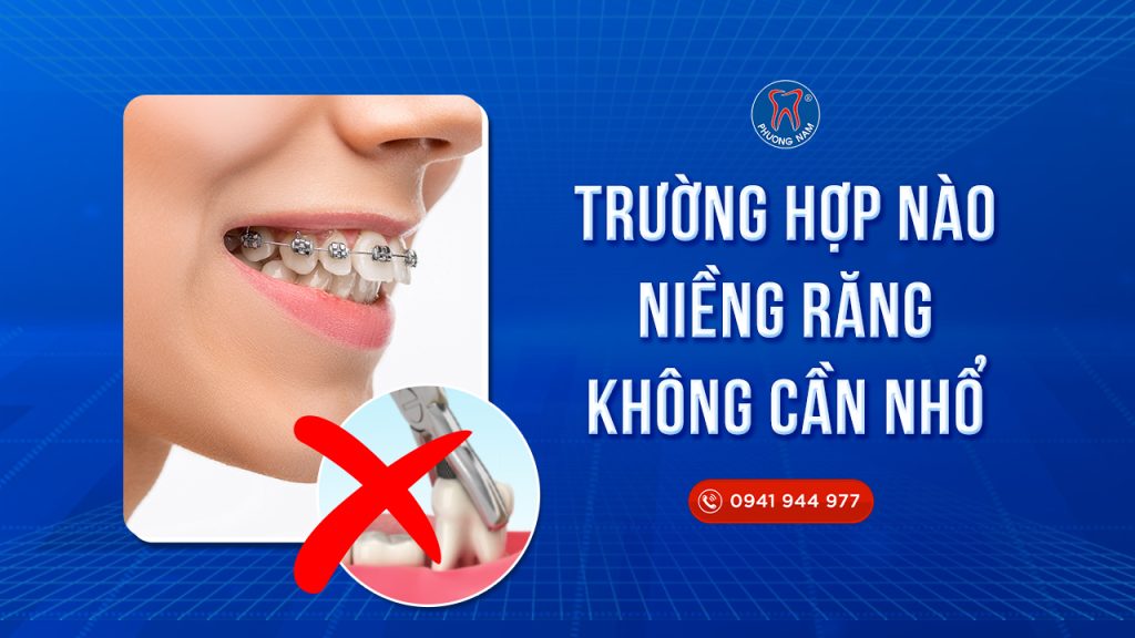 cac-truong-hop-khong-can-nho-rang-khi-nieng (2)