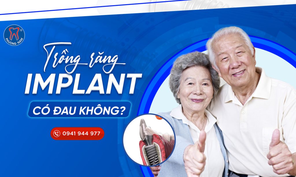 trong-rang-implant-co-dau-khong