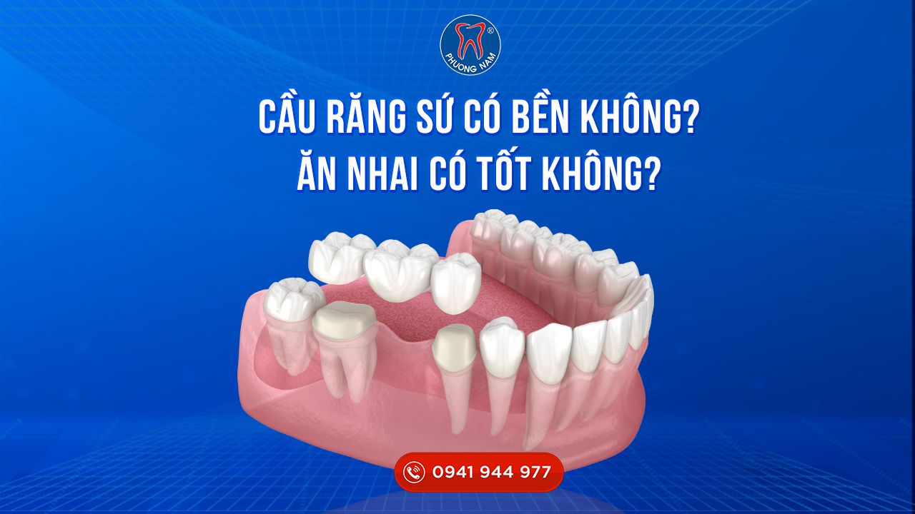 Cầu răng sứ có bền không? Ăn nhai có tốt không?