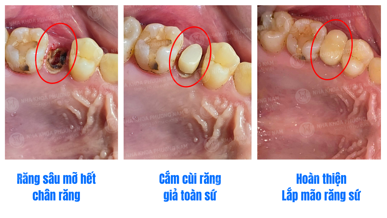 cui-rang-gia (1)