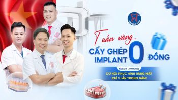 trồng implant 0 đồng