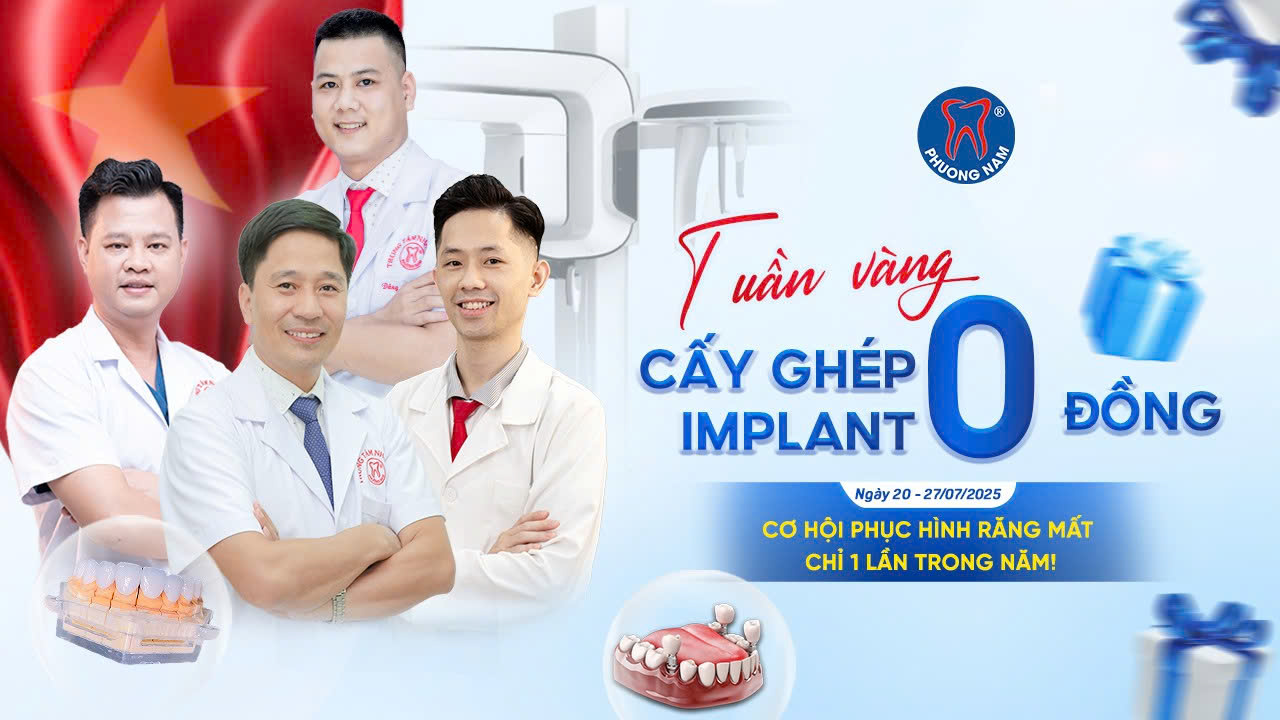 trồng implant 0 đồng