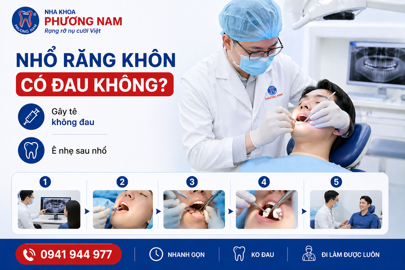 Quy trình nhổ răng khôn an toàn tại nha khoa