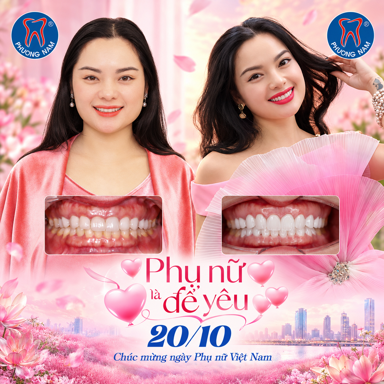 Hình ảnh trước và sau làm mới răng sứ thẩm mỹ của chị Julia Nguyễn tại Nha Khoa Phương Nam